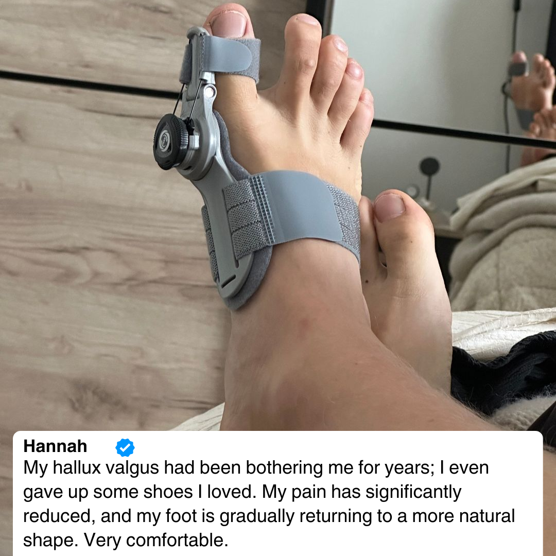 Bunion corrector | Sameo