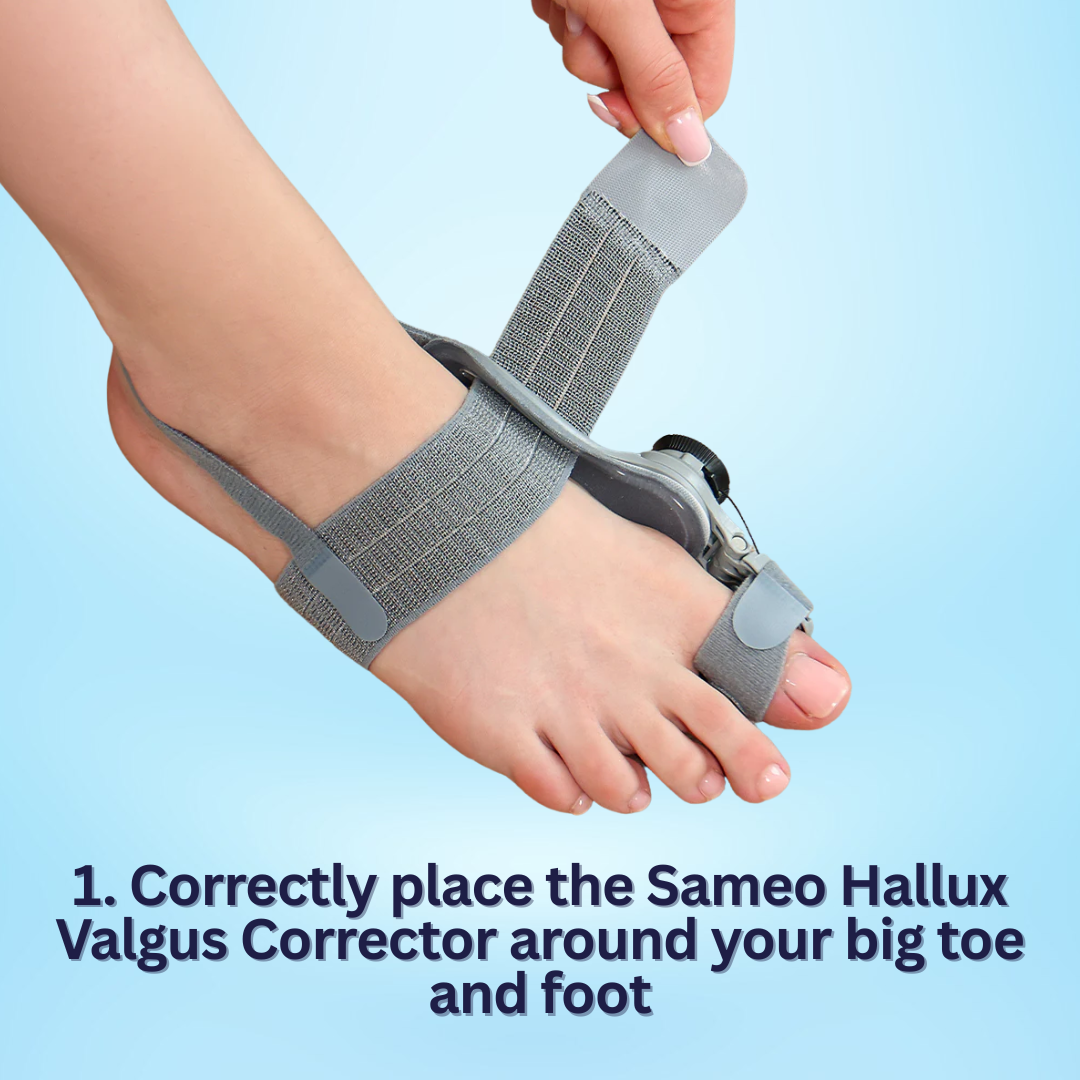 Bunion corrector | Sameo